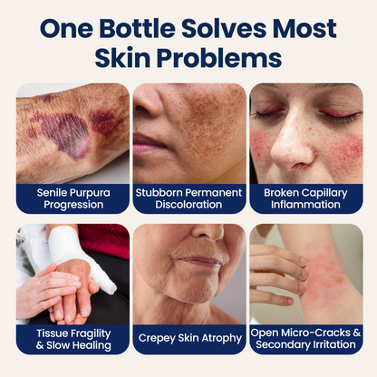 Biancat® PsoriaMucin No-Rub Itch & Flake Relief Mist