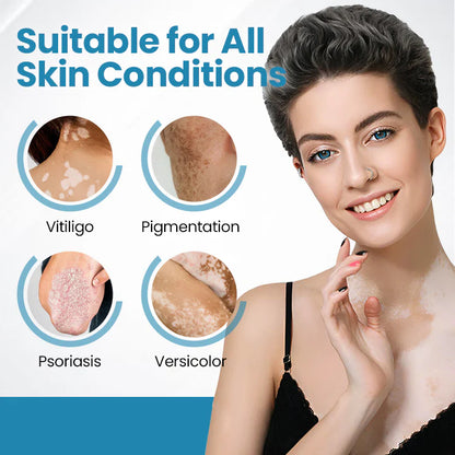 💥Biikenda® DermaBeam Vitiligo Therapy Device⏳Limited-time 49% off⏰💥