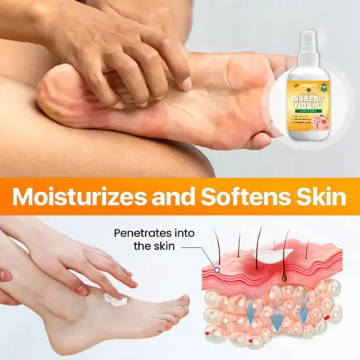 UNPREE™ Bee Venom Diabetic Wound Kolirin Spray