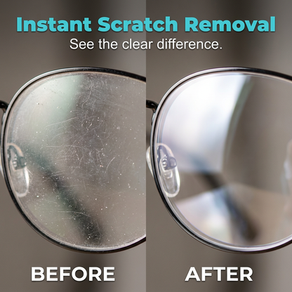 🔥HOT SALE 50% OFF😎Professional Lens Scratch Repair Spray