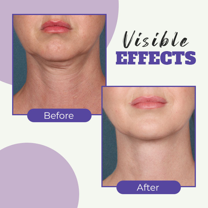 Retinol Neck Cream