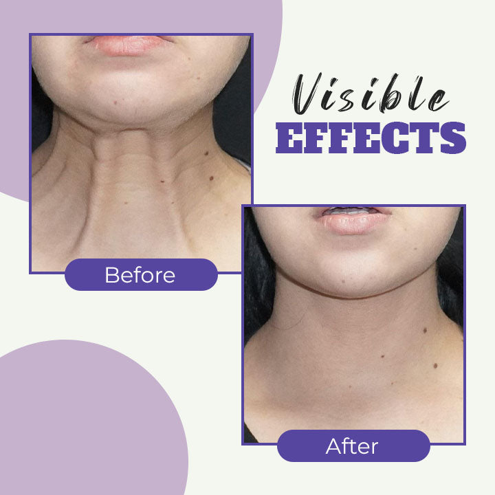 Retinol Neck Cream